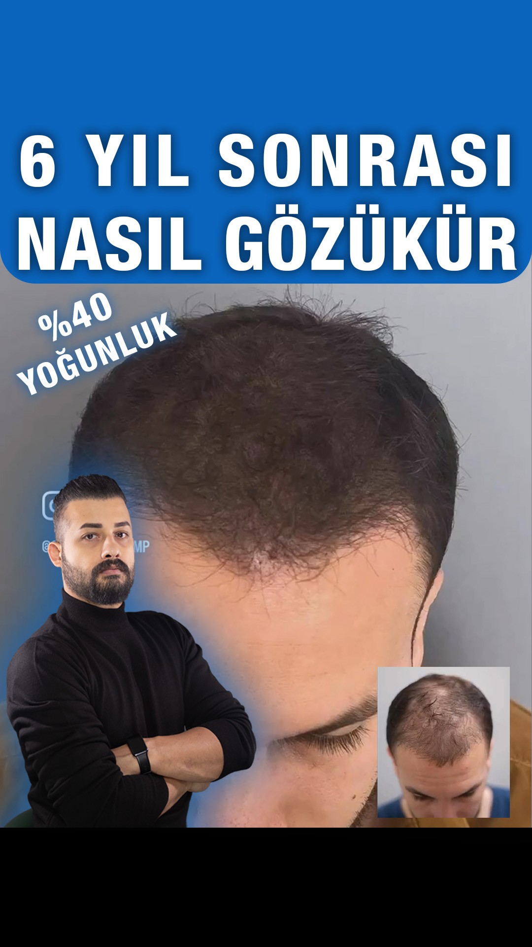 Altı yıl sonraki görünüm — Semih Deniz’in Şanlıurfa danışan arşivi