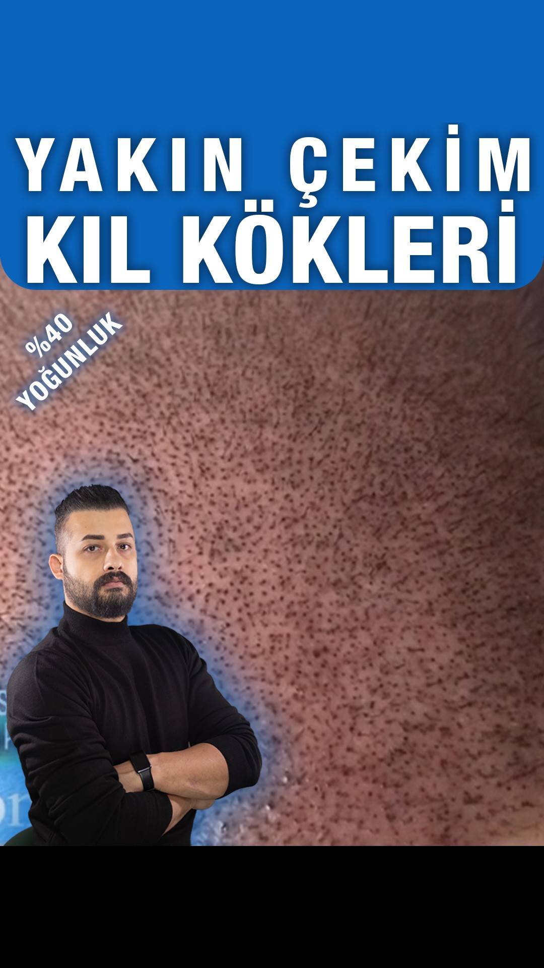 Pigment noktalarına yakın çekim — Semih Deniz’in Şanlıurfa danışan arşivi