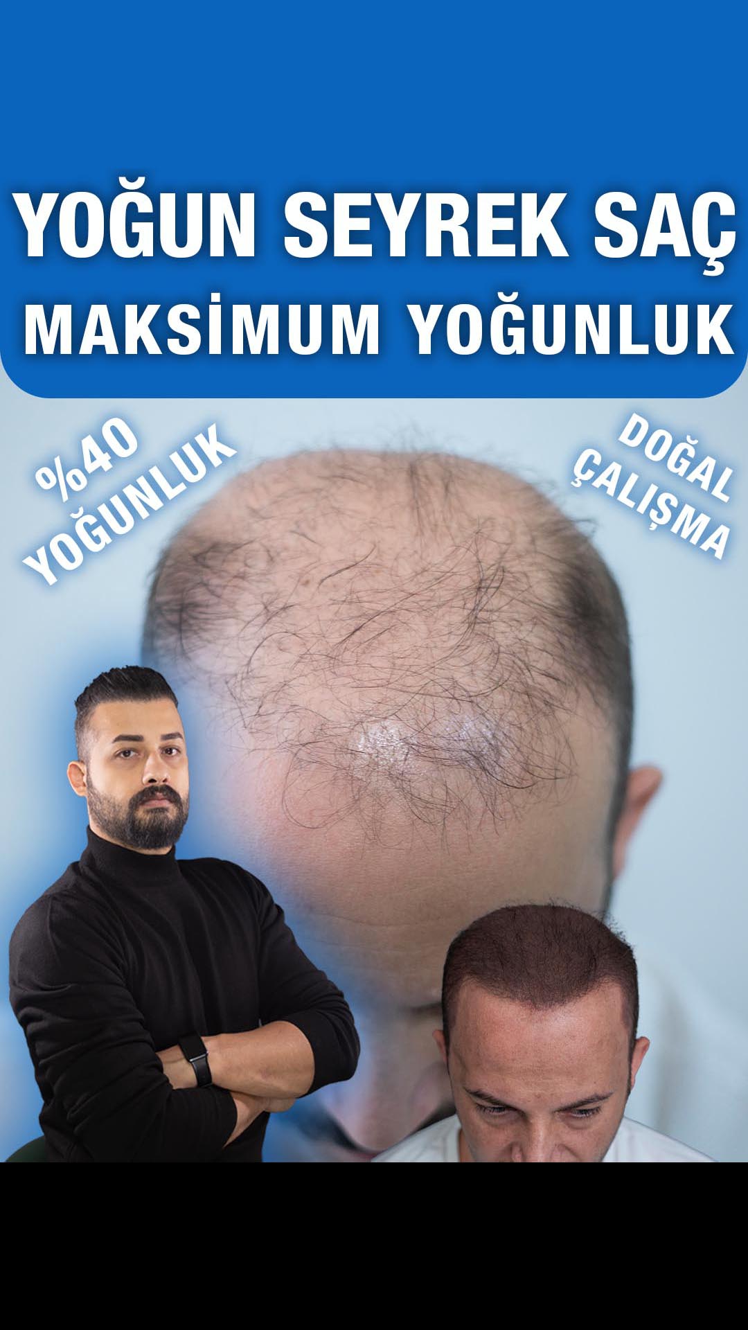 Seyrek alanda görünüm karşılaştırması — Semih Deniz’in Şanlıurfa danışan arşivi