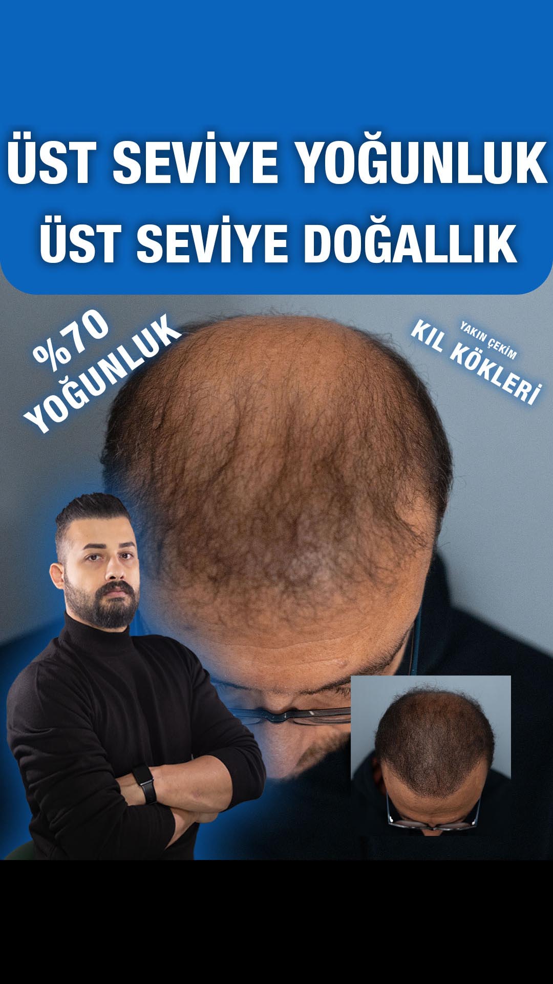 Seyrek tepe alanı — Semih Deniz’in Şanlıurfa danışan arşivi