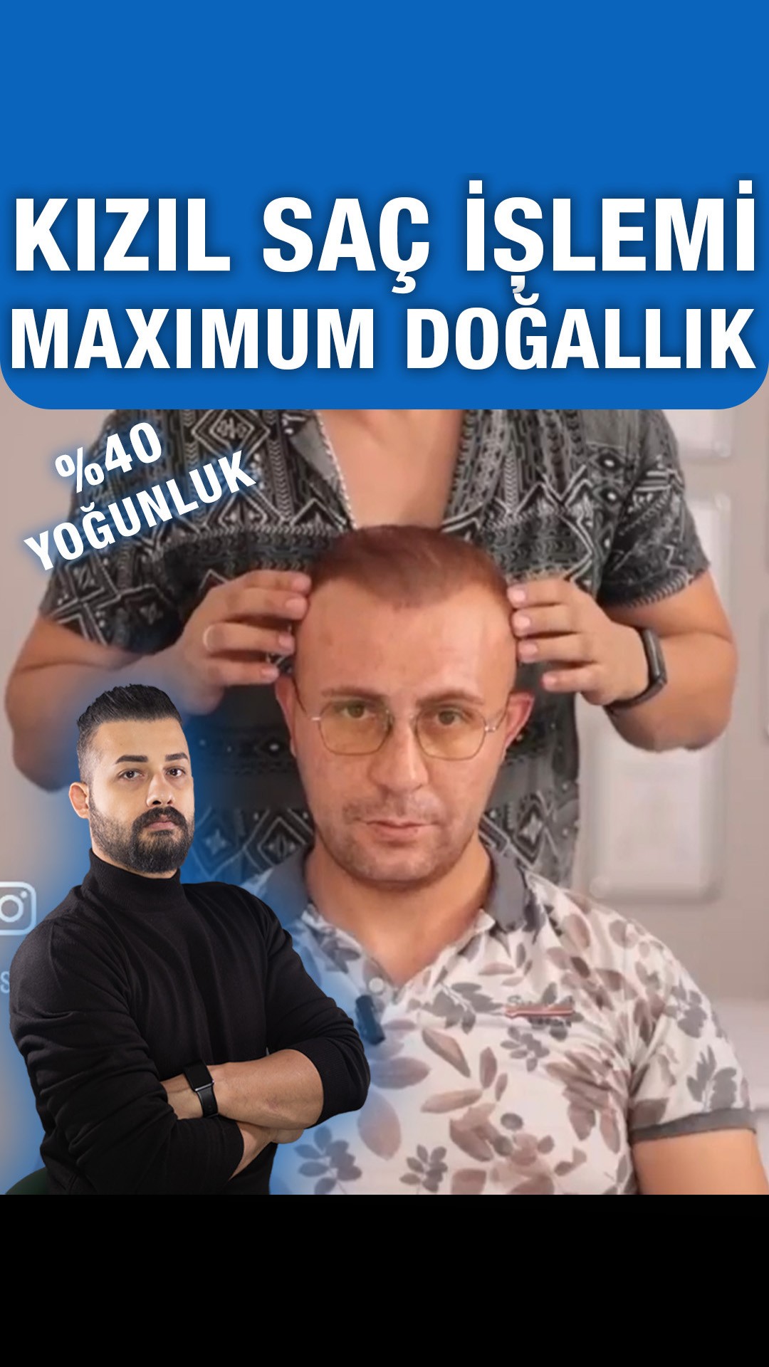 Kızıl saçta uygulama örneği — Semih Deniz’in Şanlıurfa danışan arşivi
