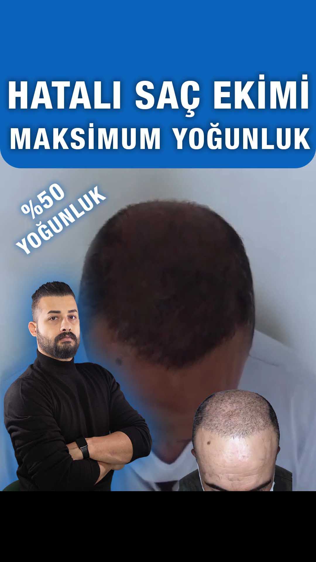 Ekim sonrası tepe bölgesi — Semih Deniz’in Şanlıurfa danışan arşivi